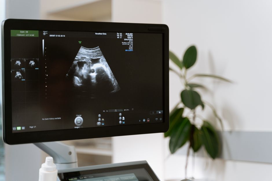 babyphone connecté Alexa Google Home